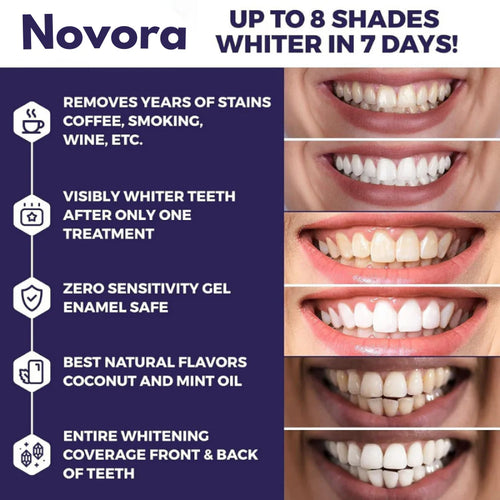 Novora Purple Teeth Whitening Strips™