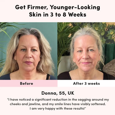 LUNA&SKIN RegenMask™